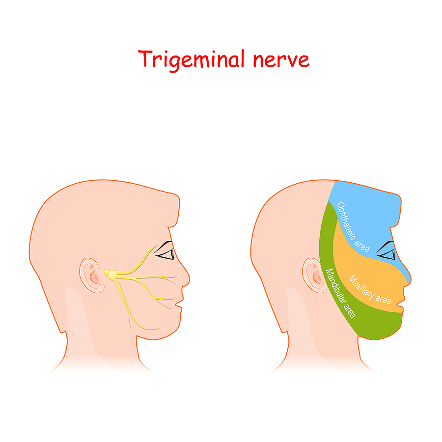 Neuralgia del trigémino